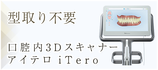 型取り不要｜口腔内3Dスキャナーアイテロ iTero